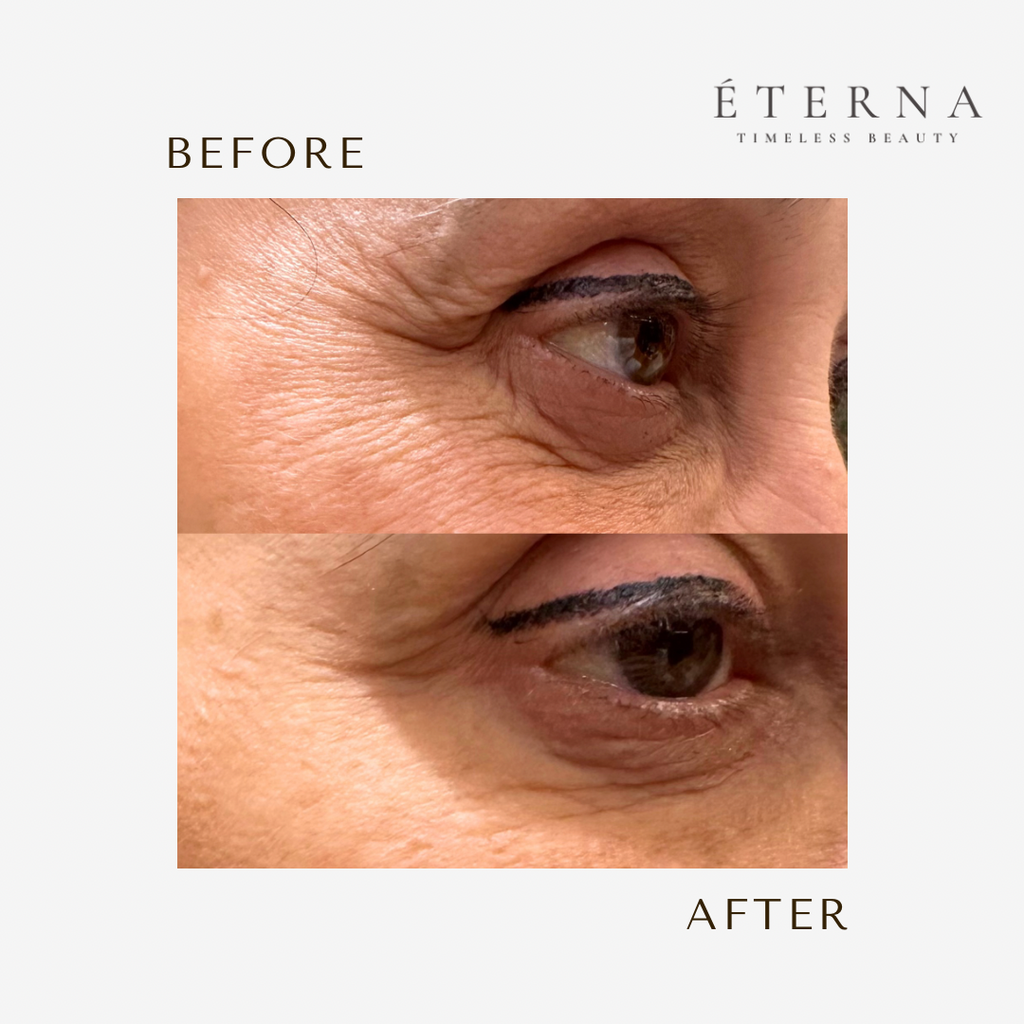 ÉTERNA - Complete Care Set