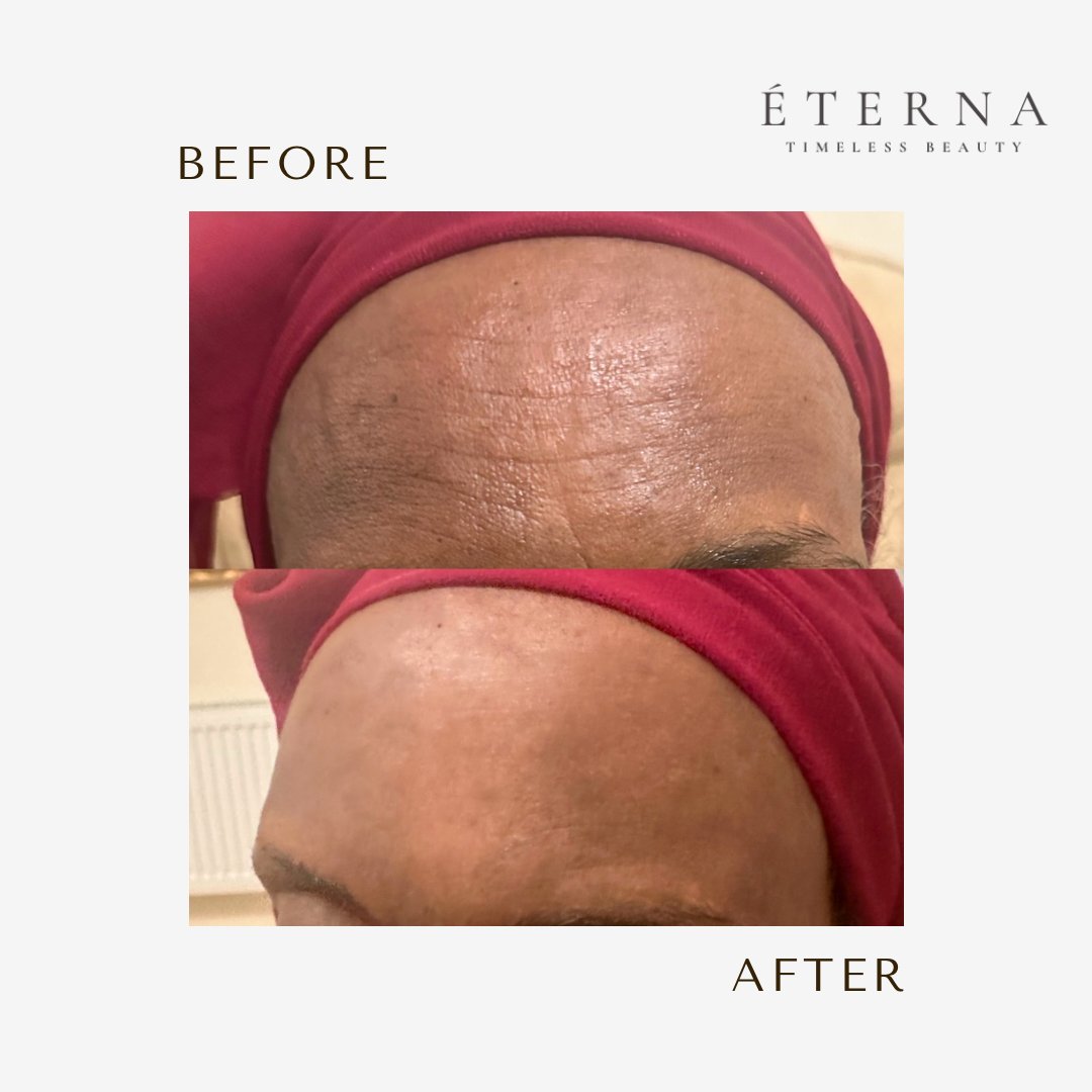 ÉTERNA - Complete Care Set